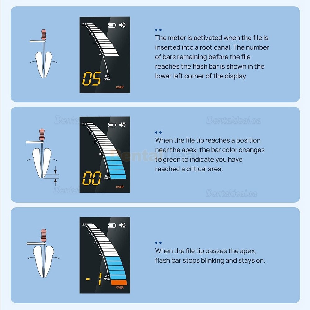 Micropex Pro Dental Apex Locator Root Canal Apex Finder Device